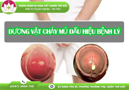 duong-vat-chay-mu-uong-thuoc-gi-hieu-qua-an-toan-1472