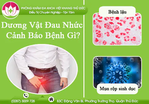 duong-vat-dau-nhuc-canh-bao-benh-gi-881