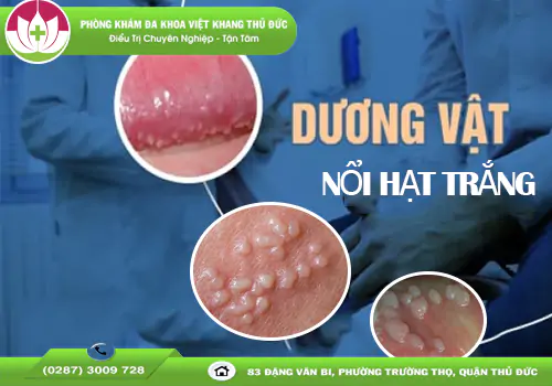 duong-vat-noi-hat-trang-co-sao-khong-dau-hieu-benh-gi-1956