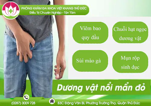 duong-vat-noi-man-do-la-dau-hieu-cua-benh-gi-455