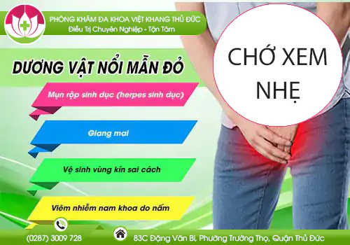duong-vat-noi-dom-do-co-lien-quan-den-benh-xa-hoi-khong-230