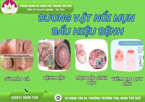 duong-vat-noi-mun-dau-hieu-canh-bao-benh-xa-hoi-can-kham-ngay-1315