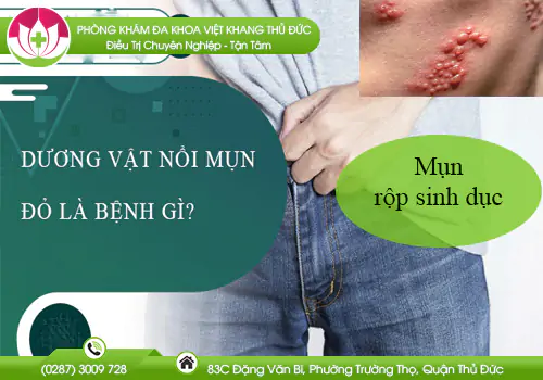 noi-mun-do-duong-vat-co-phai-benh-xa-hoi-782