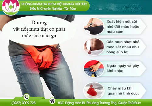 duong-vat-noi-mun-thit-can-than-mac-sui-mao-ga-779