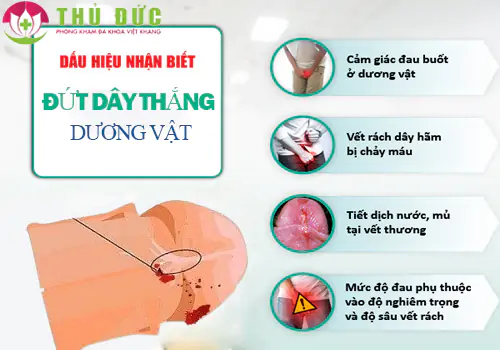dut-day-thang-duong-vat-co-nguy-hiem-khong-cach-xu-ly-1251