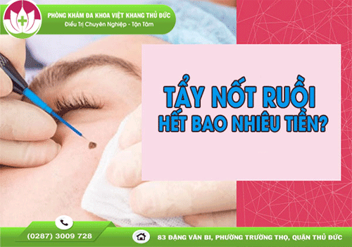 gia-pha-not-ruoi-la-bao-nhieu-goi-y-dia-chi-pha-not-ruoi-uy-tin-tai-tphcm-1758