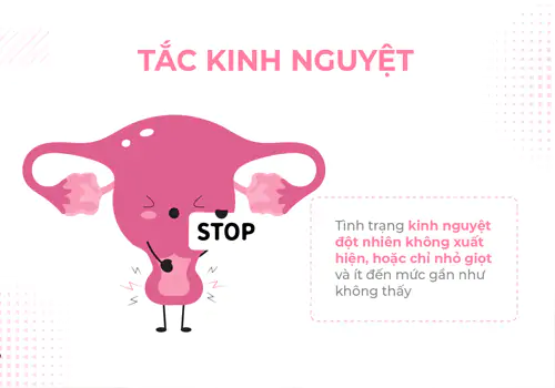 Tắc kinh là gì?