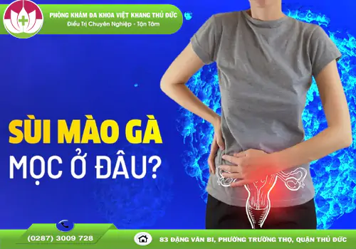 giai-dap-sui-mao-ga-moc-o-dau-va-cach-nhan-biet-som-2035
