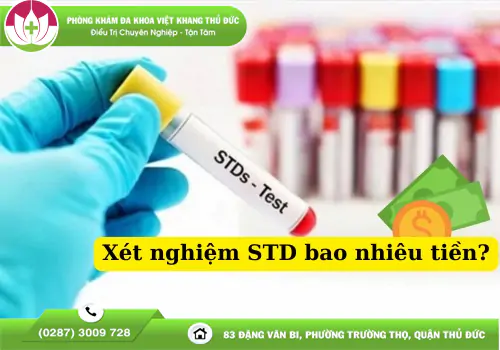 giai-dap-xet-nghiem-std-bao-nhieu-tien-1351