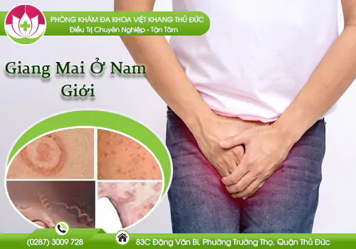 giang-mai-o-nam-gioi-ty-le-nhiem-benh-co-xu-huong-tang-cao-1040