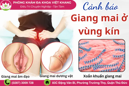 giang-mai-o-vung-kin-dac-diem-nhan-biet-benh-1705