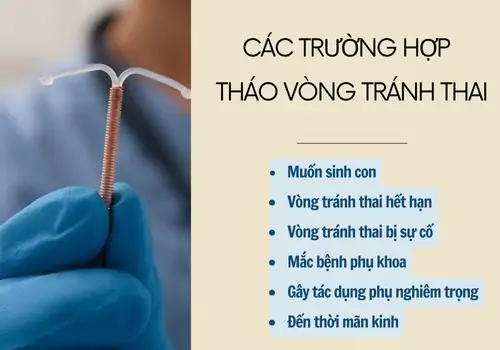 Các trường hợp thực hiện tháo vòng tránh thai