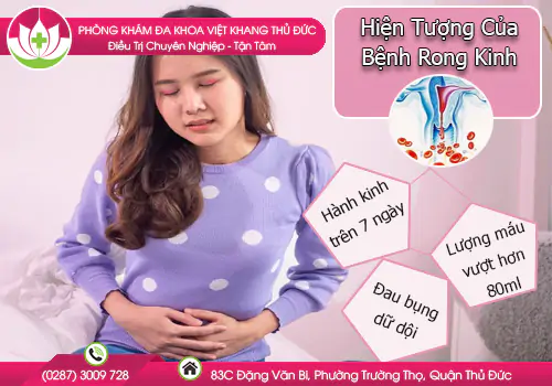 hien-tuong-cua-benh-rong-kinh-va-cach-khac-phuc-nhanh-955