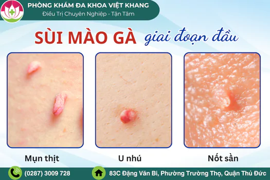 tong-hop-hinh-anh-sui-mao-ga-giai-doan-dau-1714