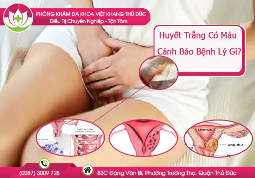huyet-trang-co-mau-canh-bao-benh-ly-gi-909