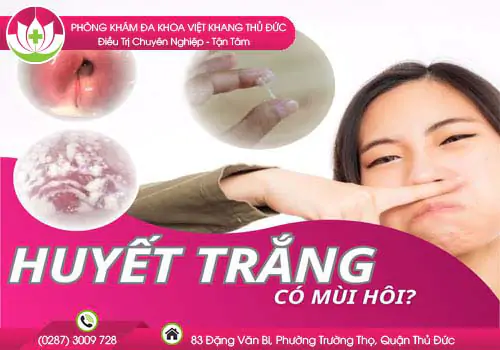 huyet-trang-ra-nhieu-co-mui-hoi-co-phai-dau-hieu-nguy-hiem-cua-benh-phu-khoa-274