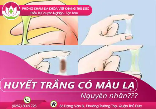 hieu-dung-ve-trieu-chung-huyet-trang-chon-ra-phuong-phap-chua-tri-phu-hop-109