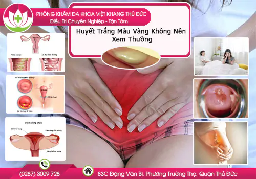 huyet-trang-mau-vang-khong-nen-xem-thuong-913