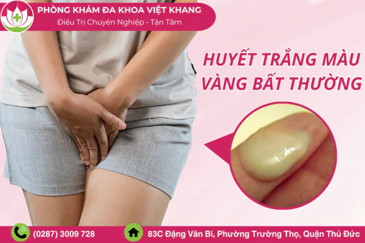 huyet-trang-mau-vang-dau-hieu-cua-benh-ly-gi-co-dieu-tri-duoc-khong-1376