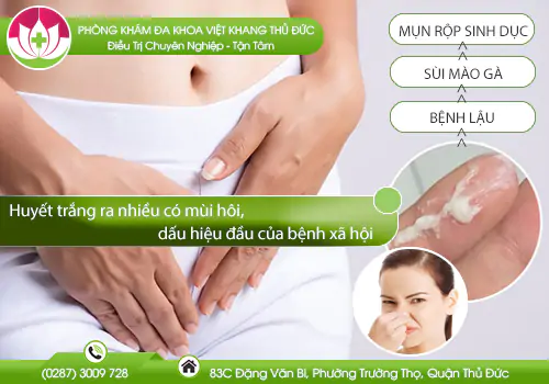 huyet-trang-ra-nhieu-co-mui-hoi-dau-hieu-dau-cua-benh-xa-hoi-806