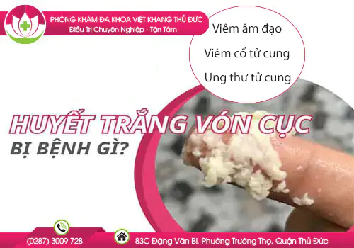 huyet-trang-von-cuc-nhu-ba-dau-co-nguy-hiem-khong-275