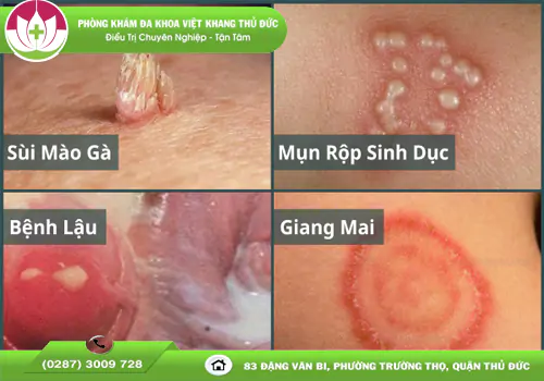 Việt Khang Thủ Đức