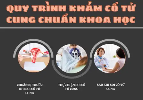 Quy trình khám cổ tử cung đúng chuẩn khoa học tại Việt Khang