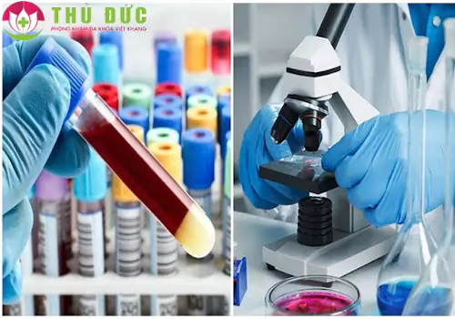 Xét nghiệm máu và nước tiểu