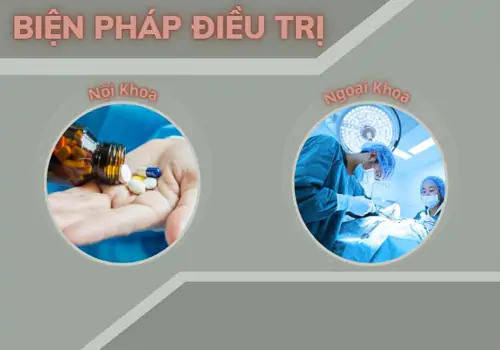 Phương pháp điều trị viêm đường tiết niệu nữ hiệu quả tại Phòng khám Việt Khang