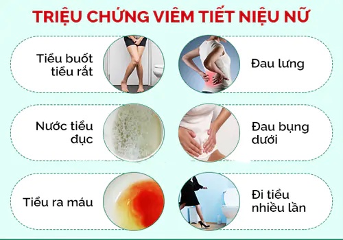 Dấu hiệu viêm đường tiết niệu nữ