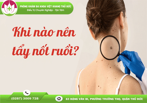 pha-not-ruoi-o-benh-vien-da-lieu-va-nhung-dieu-can-luu-y-1760