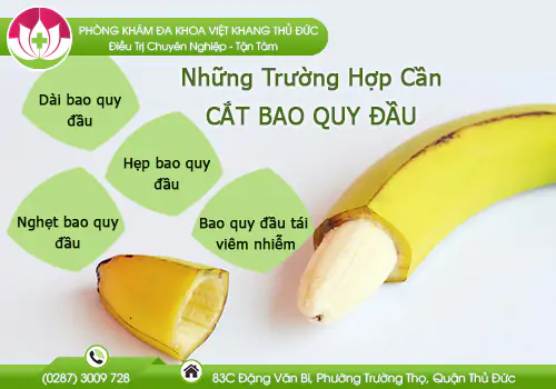 khi-nao-thi-can-cat-bao-quy-dau-987