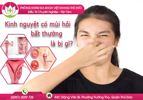 kinh-nguyet-co-mui-hoi-bat-thuong-la-bi-gi-978