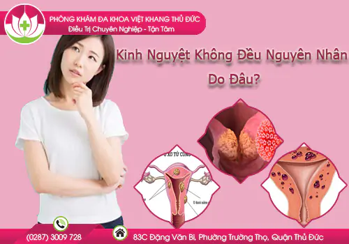 kinh-nguyet-khong-deu-nguyen-nhan-do-dau-983