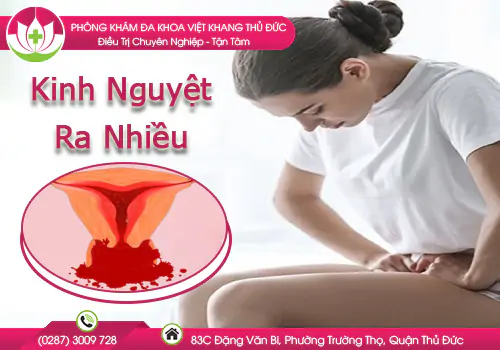 kinh-nguyet-ra-nhieu-va-cach-khac-phuc-hieu-qua-981