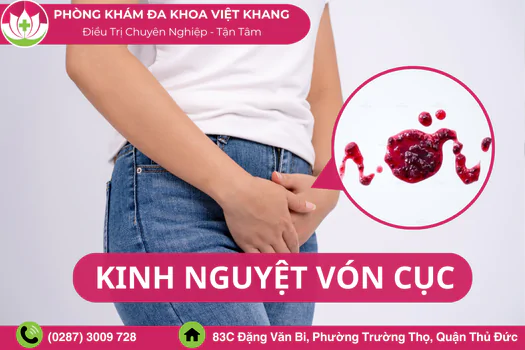 kinh-nguyet-von-cuc-chi-em-khong-nen-chu-quan-xem-thuong-1365