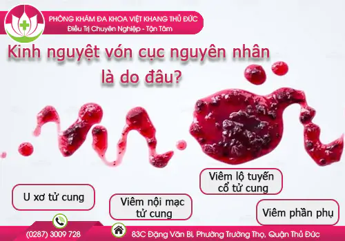 kinh-nguyet-von-cuc-nguyen-nhan-la-do-dau-977