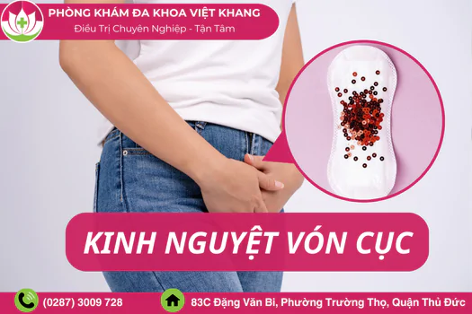 kinh-nguyet-von-cuc-dau-hieu-canh-bao-benh-phu-khoa-khong-nen-chu-quan-1353