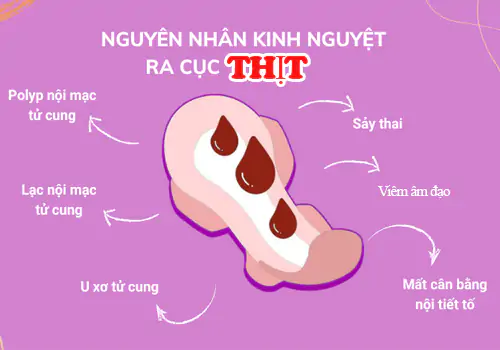 kinh-ra-cuc-thit-dau-hieu-can-biet-va-khi-nao-di-kham-bac-si-1160