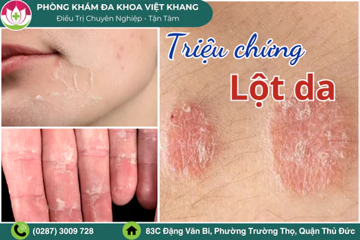 lot-da-thuong-xuyen-la-dau-hieu-cua-benh-gi-1805