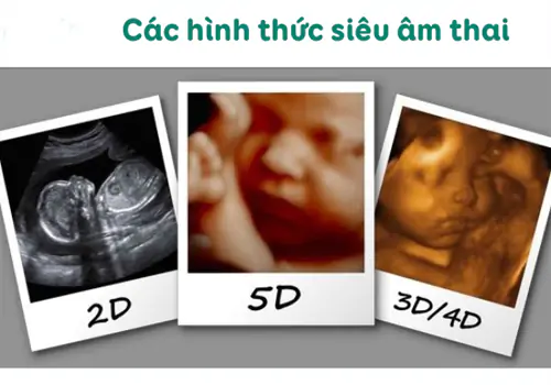 Các phương pháp siêu âm tốt và được áp dụng phổ biến hiện nay