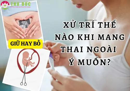 mang-thai-ngoai-y-muon-phuong-phap-xu-ly-an-toan-1294