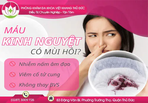nguyen-nhan-kinh-nguyet-co-mui-tanh-hoi-la-do-dau-226