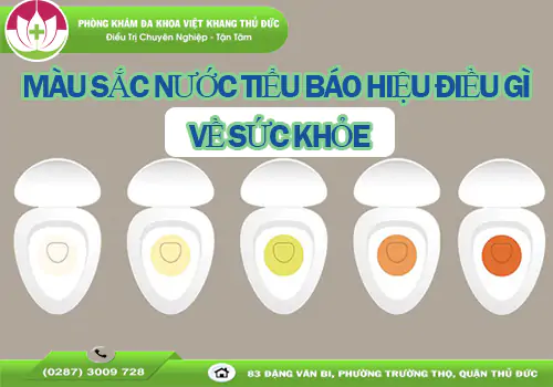 mau-sac-nuoc-tieu-bao-hieu-dieu-gi-ve-suc-khoe-cua-ban-1508