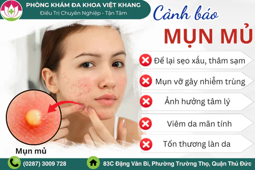 lam-gi-khi-noi-mun-mu-cach-lam-xep-mun-nhanh-1810