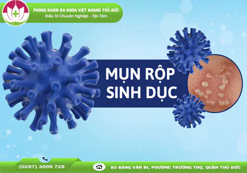 mun-rop-sinh-duc-ban-co-thuc-su-hieu-ro-1611