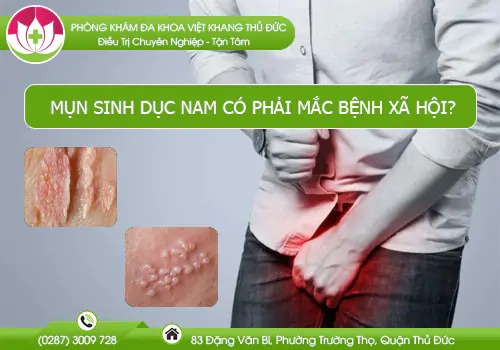 mun-sinh-duc-nam-co-phai-mac-benh-xa-hoi-691