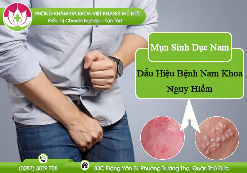 mun-sinh-duc-nam-co-nguy-hiem-khong-878