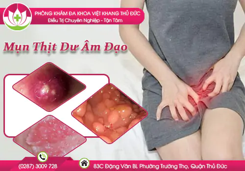 dieu-tri-mun-thit-du-am-dao-an-toan-khong-dau-1080
