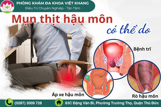 canh-bao-mun-thit-hau-mon-do-benh-xa-hoi-1712